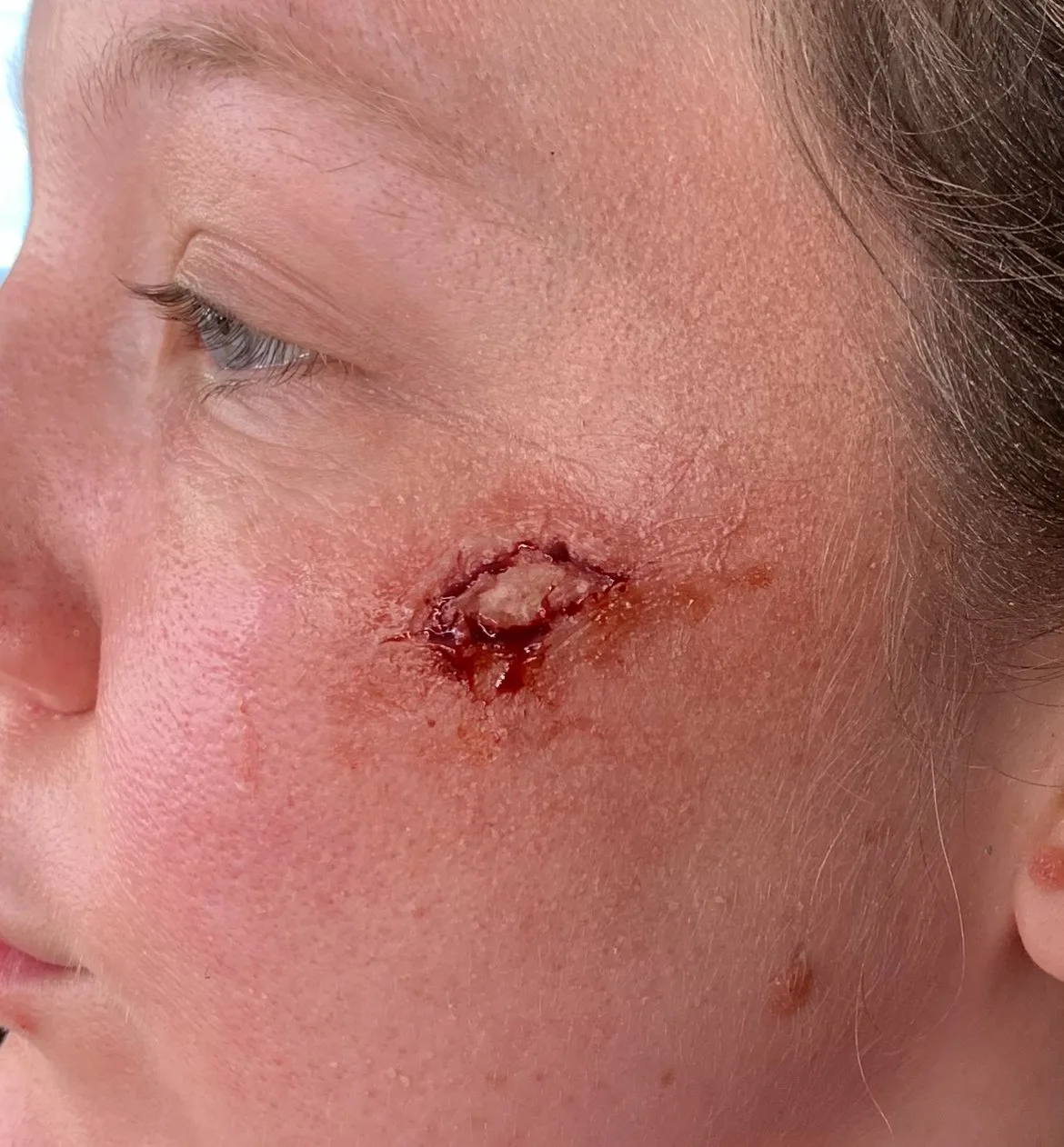 Hair punching and silicone painting