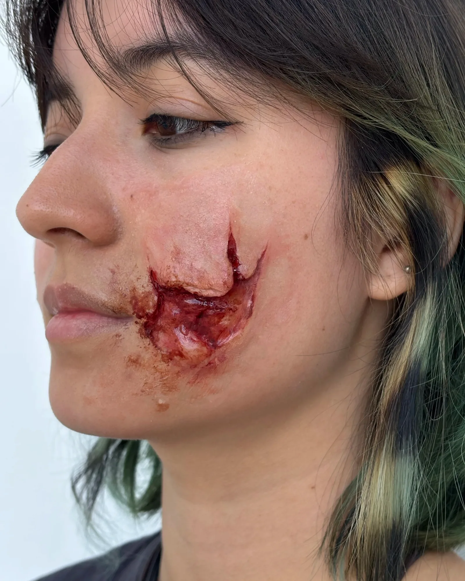 Prosthetics study