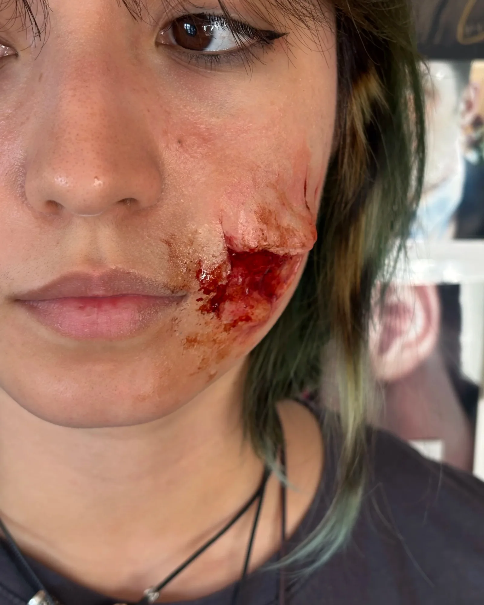 Prosthetics study