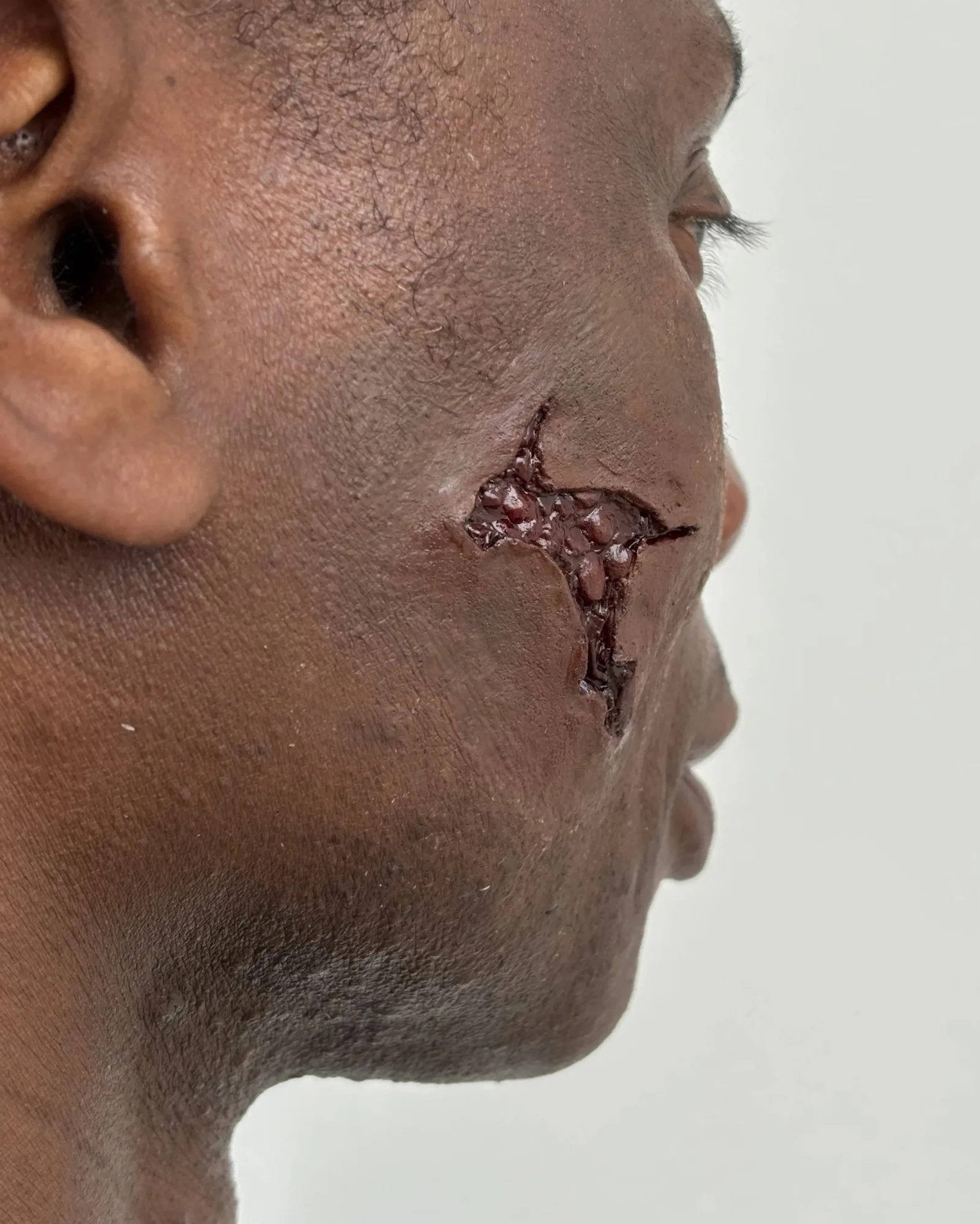 Prosthetics study